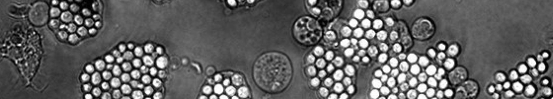 Hogyan változik meg a sejtek működése az űrben a mikrogravitáció hatására?